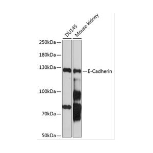 E-Cadherin Rabbit