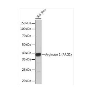 Arginase 1 (ARG1)