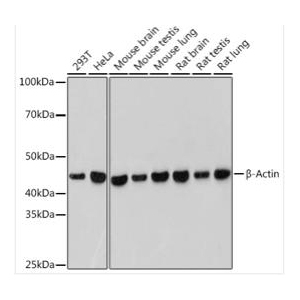 β-Actin Rabbit mAb